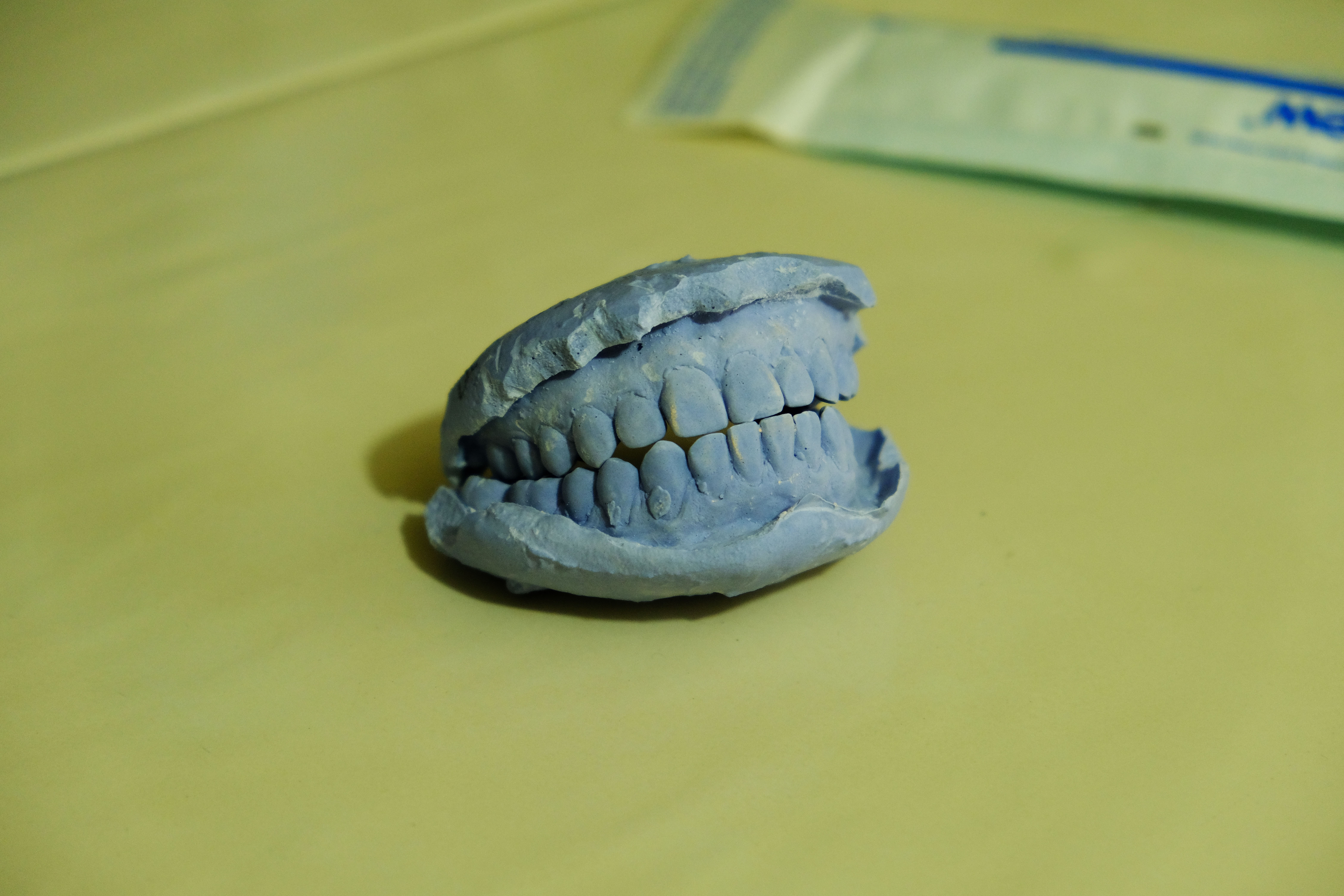 Molde dental